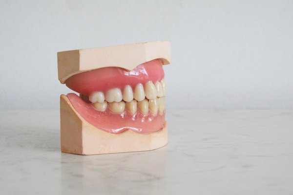 Tooth Trends: Dental Fangs