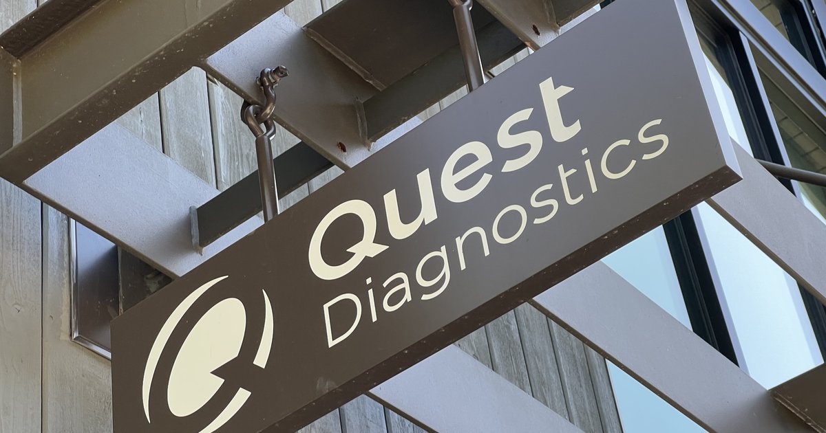 New Alzheimer’s blood test has clinicians doubtful of its efficacy