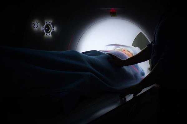 Lung Cancer Screenings