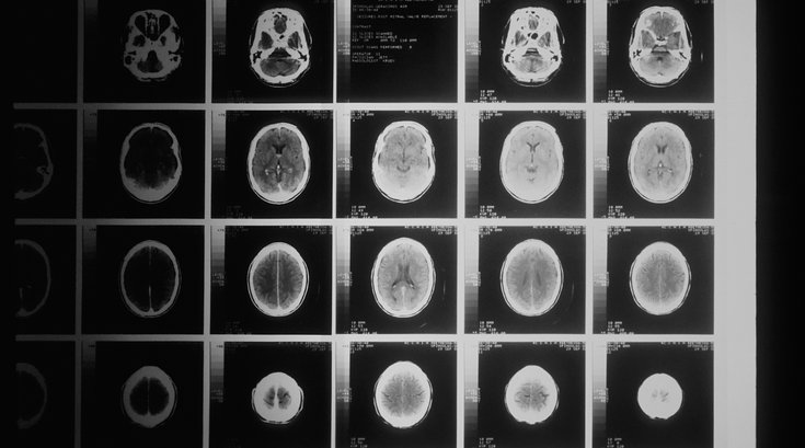 CT imaging for cancer