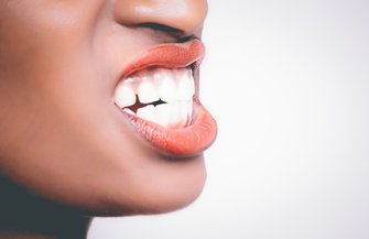 Teeth Grinding Bruxism