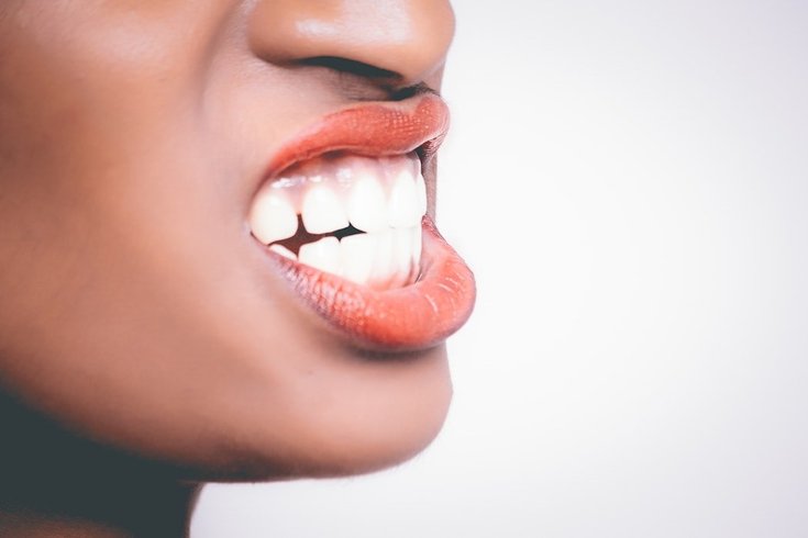 Teeth Grinding Bruxism