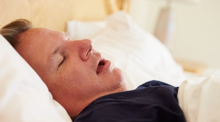 Sleep Apnea Alzheimer's