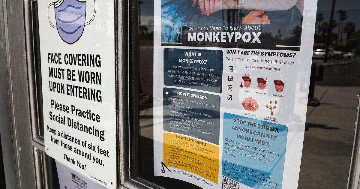 Mpox rapid test developed by Penn State researchers following global outbreak - Vimarsana News