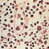 Hantavirus Update CDC