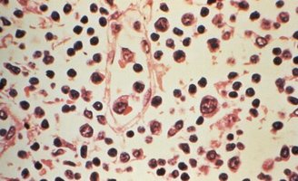 Hantavirus Update CDC