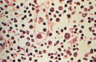 Hantavirus Update CDC