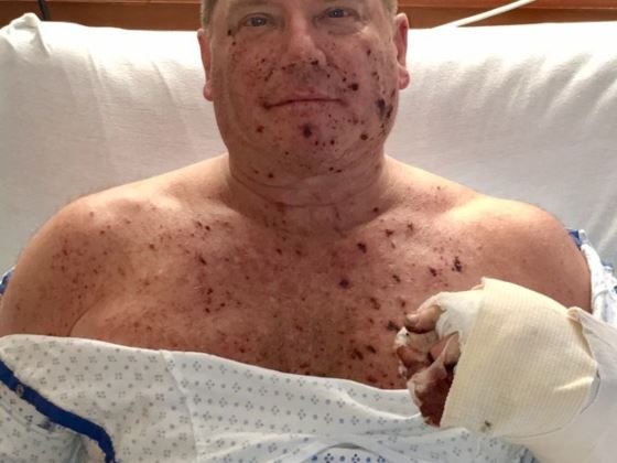 Philly letter bomb victim 