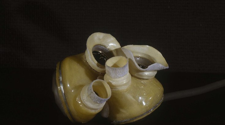 05072015_ArtificialHeart_AP