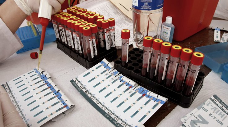 1042016_HIVTest
