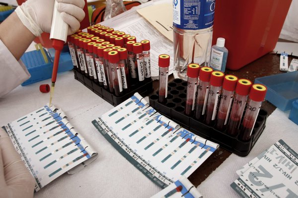 1042016_HIVTest