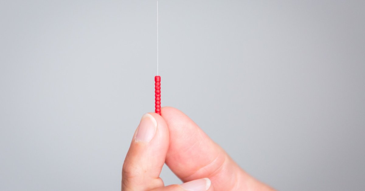 Medicare mulls decision to cover acupuncture for lower back pain