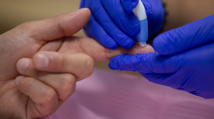 Alzheimers blood test