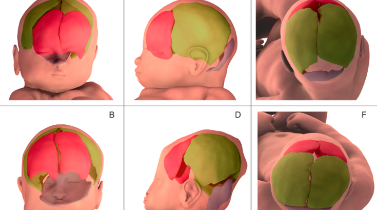 Baby Skulls
