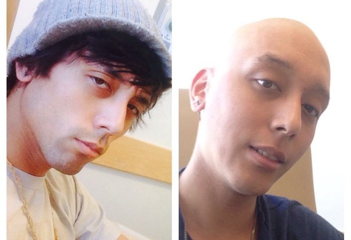 Before and After Chemo