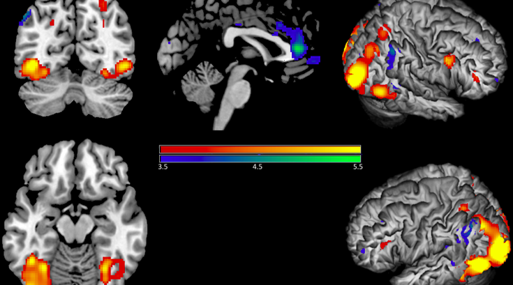 Brain_Image_Deactivations_Empathy