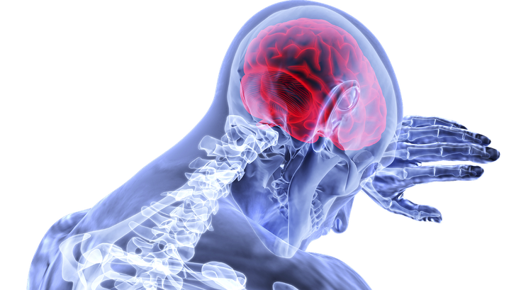COVID-19 and the brain