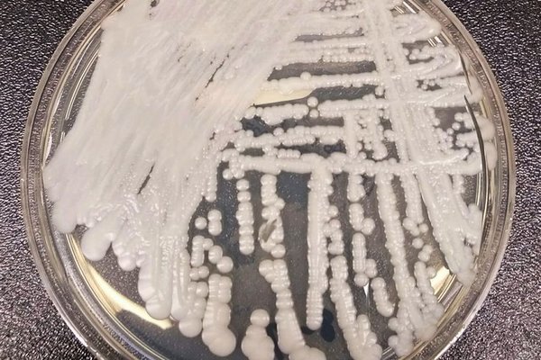 Superbugs CDC infections antibiotic-resistant bacteria