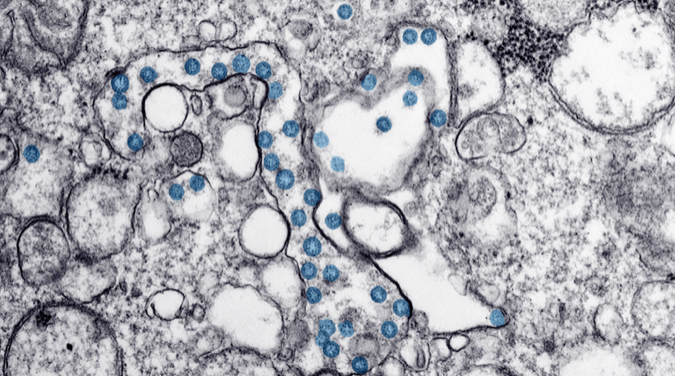 Delco Coronavirus First Deaths