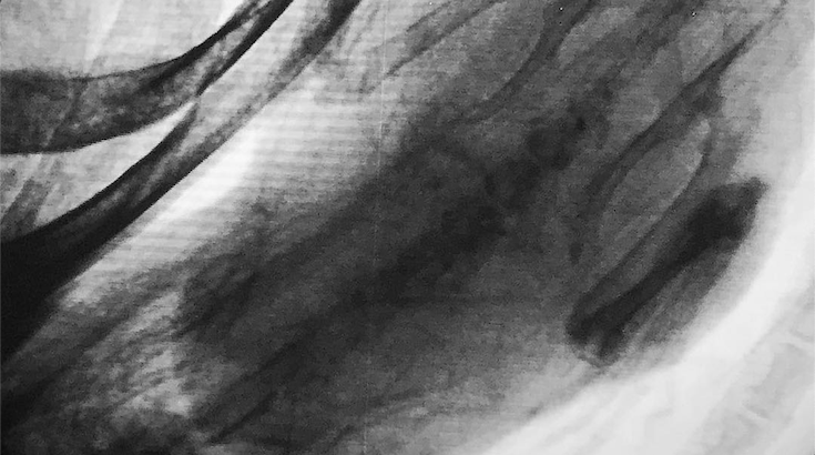 Rat X-ray