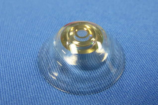 Telescopic contact lenses