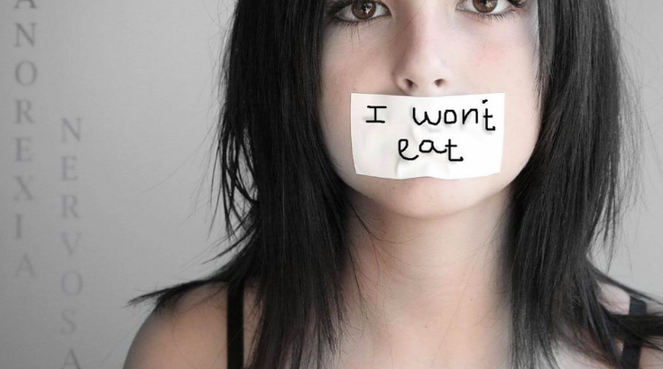 Anorexia