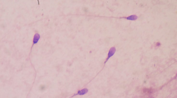 Sperm_Stained