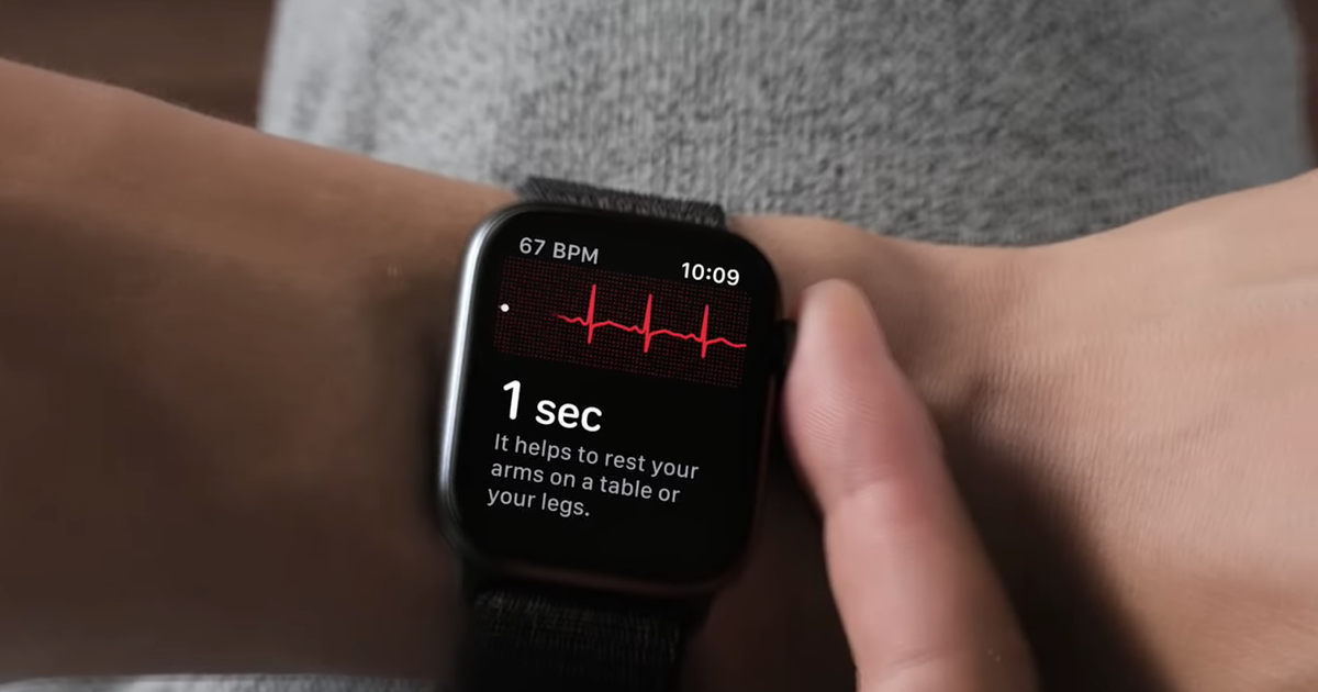 android watch ekg