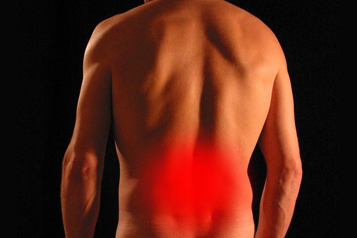 Back pain improved by hip replacement