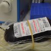 COVID antibody testing on blood donation