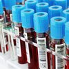 blood tests fasting