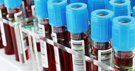 blood tests fasting