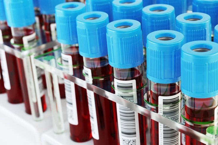 blood tests fasting