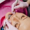 Dental Work being done on a patient