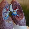 Vaping Double Lung Transplant Detroit