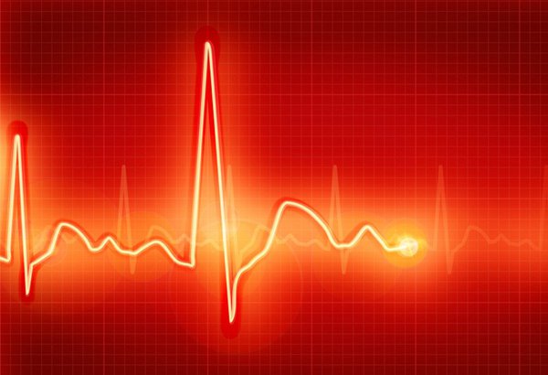 atrial fibrillation
