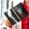 Female radiologist hold in hand xray film stock photo