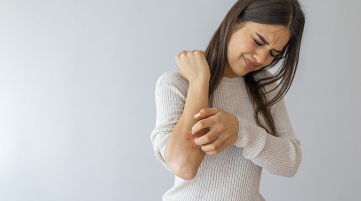 Woman scratching itch on arm