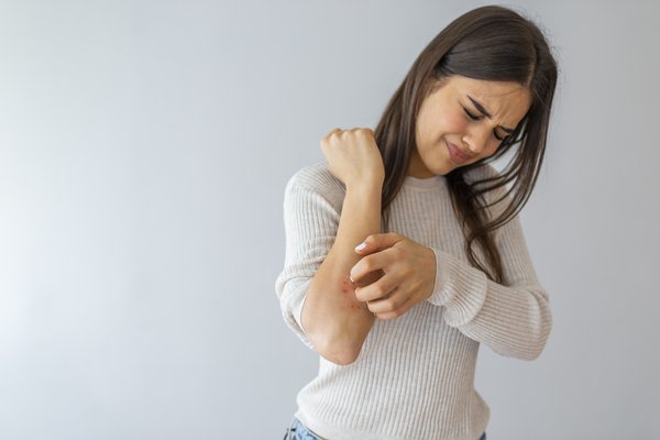 Woman scratching itch on arm