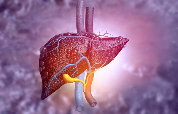 Diseased liver llustration