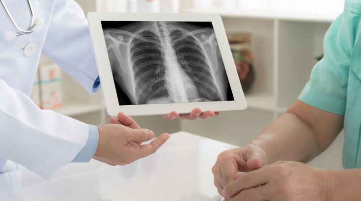 X-ray medical stock photo