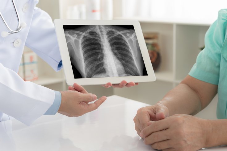 X-ray medical stock photo