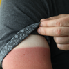 Purchased - sunburn under sleeve