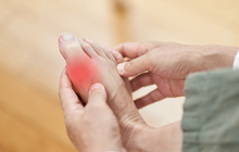 Limited - The feet of a man suffering from gout