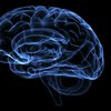 Limited - Brain - Alzheimer's Association - Sponsored Content