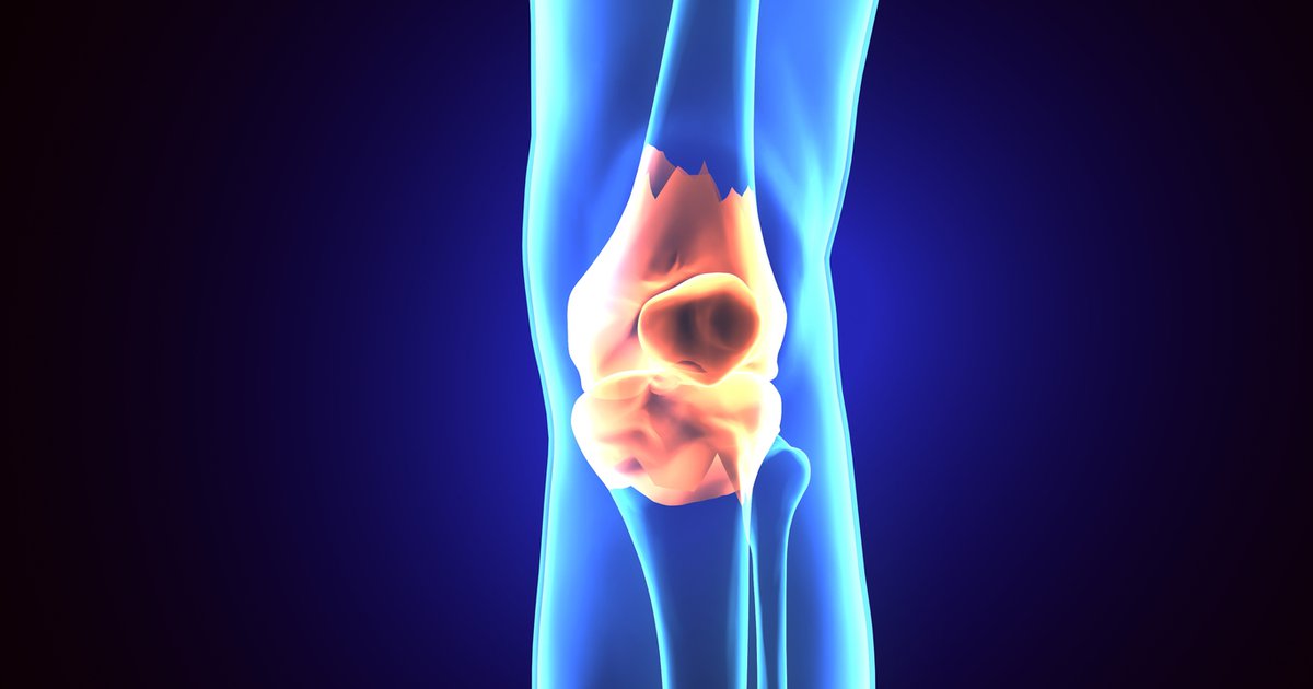 Three things you can do now to prevent joint replacement - Vimarsana News