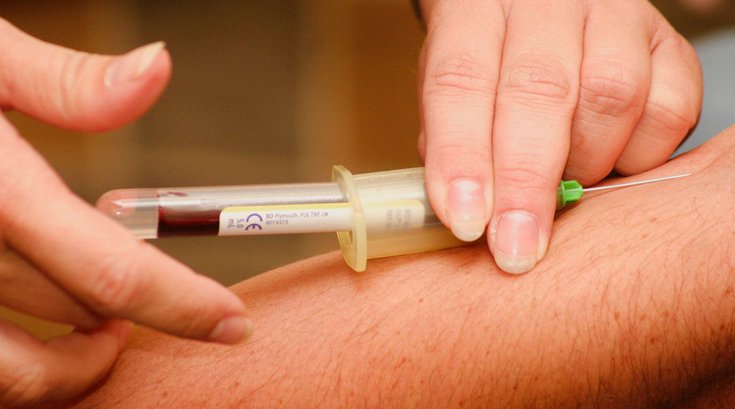 New Alzheimer's blood test