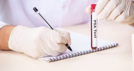 new prostate cancer tests