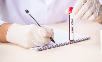 new prostate cancer tests