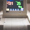 ECG Stock Image
